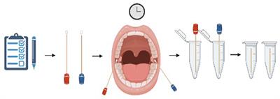 The effect of physical and psychological stress on the oral microbiome